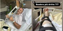 “Operazione finita. Sembra più dritta?”: la foto postata da Zambrotta dopo l’intervento per risolvere il varismo