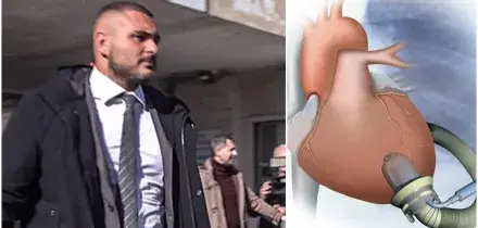 Cuore &ldquo;bruciato&rdquo;, l&rsquo;avvocato: &ldquo;L&rsquo;ospedale Monaldi ha valutato tutte le possibilit&agrave; per salvare il bimbo?&rdquo;. L&rsquo;ipotesi di un organo artificiale