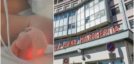 Torino, &egrave; morto il bimbo di cinque mesi caduto dalle scale di casa: si indaga per omicidio colposo