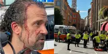 &ldquo;L&rsquo;ho braccato e mi ha dato due coltellate&rdquo;: parla l&rsquo;uomo che ha bloccato il conducente dell&rsquo;auto che ha travolto 8 persone a Modena