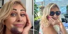&ldquo;La settimana scorsa in Sicilia ho avuto un incidente stradale. Un trattore si &egrave; immesso sulla strada dov&rsquo;ero con i miei amici in auto&rdquo;: il racconto di Marina Di Guardo