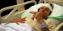 &ldquo;Alcune ferite erano cos&igrave; profonde che si vedeva il cranio e c&rsquo;erano ancora piccoli pezzi di barriera corallina incastrati all&rsquo;interno&rdquo;: il racconto choc del surfista Rudy Ghiara