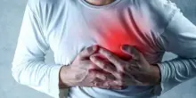 La plastica che ci ostruisce il cuore: nei pazienti con infarto acuto l&rsquo;84% ha frammenti nelle arterie