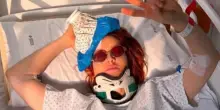 Parla Noemi dopo la caduta dal palco: &ldquo;Devo fermare il tour per 4 settimane. Mi sono presa un grande spavento, qualche acciacco e un po&rsquo; di dolore. Ma sto bene&rdquo;