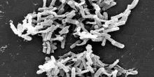 Clostridium difficile, cos&rsquo;&egrave; il batterio sospettato per la morte di un bimbo a Catanzaro: come si trasmette, i sintomi e le cure