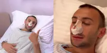 &ldquo;Finalmente ho fatto l&rsquo;intervento di chirurgia al naso. Potete criticarmi quanto volete, ma il mio volermi bene va sopra tutto&rdquo;: parla Ramon, il ballerino di Amici