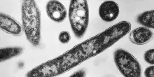 Focolaio di legionella a Basilea, un morto 26 casi: &ldquo;Verifiche su torri di raffreddamento per uffici&rdquo;