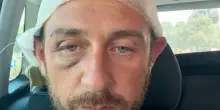 In 30 contro 1 dopo una serata a Olbia: &ldquo;Vattene via fr&hellip;io&rdquo;. Il racconto del 39enne aggredito: &ldquo;Ragazzini come marionette seguono pensieri e azioni pi&ugrave; grandi di loro&rdquo;