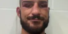 &ldquo;Torneremo, il tempo di far sgonfiare la faccia. Nessuno mai me ne aveva date cos&igrave; tante&rdquo;: cos&igrave; Morello dopo la sconfitta con Liddard