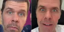 &ldquo;Perez Hilton &egrave; sfigurato, ha perso molto sangue e i tanti punti di sutura lasceranno molte cicatrici. Ci vorranno mesi, forse anni prima che torni a stare bene&rdquo;