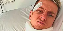 &ldquo;Pu&ograve; rischiare la paralisi. Pericoloso tornare in bici se non guarisce completamente&rdquo;: il medico specialista avverte Pogacar