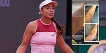 Us Open, Stefanini mostra un livido sul braccio: &ldquo;Colpa di un controllo antidoping, non trovavano la vena e muovevano l&rsquo;ago. Stesso trattamento per tutte?&rdquo;