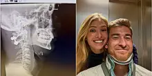 &ldquo;Ho rischiato di non camminare pi&ugrave;, non riuscivo a muovere il collo. Ora ho quattro viti&rdquo;: cos&igrave; Klinsmann jr