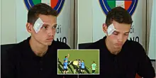 Arbitro 19enne colpito da un sasso durante una partita: follia in Campania. La vittima: &ldquo;Torno presto in campo&rdquo;