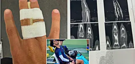 &ldquo;Mi sono rotto un dito in allenamento&rdquo;: Musetti si ritira anche da Tokyo, continua il calvario. Tutti gli infortuni del 2026