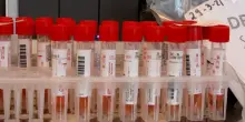 Ebola, il punto sulla situazione della malattia in Italia