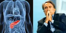 Emilio Fede, la malattia: il tumore al pancreas nel 2014, la diagnosi "sbagliata", gli esami del sangue ogni 3 mesi e il ricovero