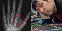 Mago si impianta un microchip nella mano, ma dimentica la password: &laquo;Sono tagliato fuori dal mio corpo&raquo;