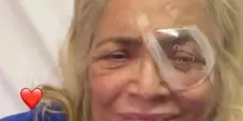Mara Venier in ospedale, operata all'occhio: &laquo;Finiamo l'anno cos&igrave;&raquo;. La conduttrice soffre di maculopatia: cos'&egrave;