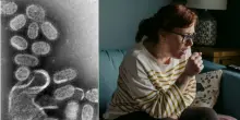 Influenza K, sintomi durano 3 volte di pi&ugrave;: tosse e raffreddore oltre 20 giorni. Il medico: &laquo;Ecco la dieta per riprendersi&raquo;