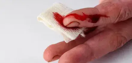 Mafie, il rito della &laquo;pungitara&raquo;: come si entra nel clan Gagliardi e chi &egrave; il boss Angelo