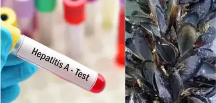 Epatite A in Campania e nel Lazio, indagano Procura e Nas di Napoli. &laquo;Vendita di alimenti pericolosi per la salute&raquo;