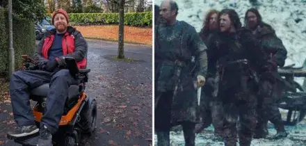 Michael Patrick &egrave; morto a 35 anni: l'attore de Il Trono di Spade ha recitato sul palco fino alla fine. Cos'&egrave; la malattia del motoneurone