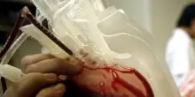 Malata di leucemia muore durante un'infusione di sangue manipolato geneticamente. La famiglia denuncia, disposta l'autopsia