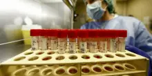 Roma, gli istituti di ricerca in rete: una scommessa sulle nuove cure