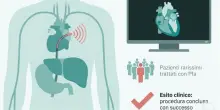 Ha il cuore a destra (invece che a sinistra), paziente operato a Terni: l'intervento per ricostruire le cavit&agrave; cardiache