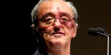 Tumore al pancreas, ritirato lo studio di Mariano Barbacid che parlava di ?svolta? sulla regressione: cosa non torna