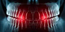 Denti che ricrescono da soli? Anticorpo (made in Japan) trasforma la fantascienza in cura