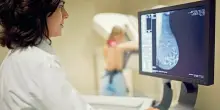 Tumore al seno, perch&eacute; le nuove terapie (come l'immunoterapia) non funzionano per tutte? La risposta dalla ricerca