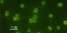 &laquo;Ecco come un virus dell'Impero romano si &egrave; conservato in un vaso da notte e diffuso in Europa&raquo;. La nuova scoperta