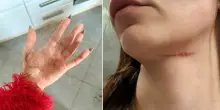 &laquo;Io, aggredita dagli ultras del Venezia sul vaporetto: presa per il collo e a pugni in faccia. Poi inseguita con il mio fidanzato&raquo;