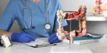 Tumore colon retto, lo studio che parte da Napoli: ?Il ?tocco gentile? riduce infiammazione e complicanze?