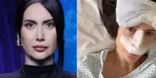 Jessica Morlacchi operata al naso per la quinta volta: &laquo;Spero di tornare a respirare&raquo;. La foto post intervento