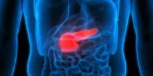 Tumore al pancreas, una nuova pillola raddoppia il tempo di sopravvivenza rispetto alla chemioterapia