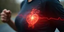 Ischemia cardiaca nei giovani: cos'&egrave;, sintomi e perch&eacute; pu&ograve; causare una morte istantanea