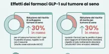 &laquo;Cancro al seno, i farmaci per la perdita di peso riducono il rischio di tumore fino al 30%&raquo;