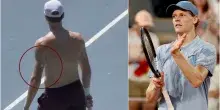 Sinner e lo strano cerotto sul braccio durante gli allenamenti a Montecarlo, cos'&egrave; e a cosa serve (e perch&eacute; lo sta usando in ottica Wimbledon)
