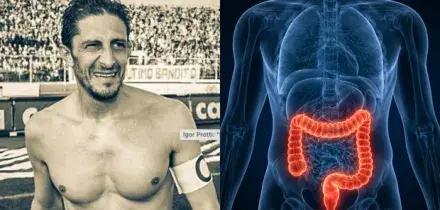 Protti morto per un tumore al colon: sintomi, prevenzione e cure della malattia che lo aveva colpito