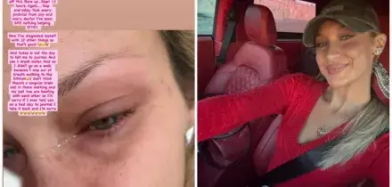 Bella Hadid e la sindrome di Lyme: &laquo;Penso di avercela fatta, poi arriva una ricaduta e cambia tutto. Il dolore inizia prima ancora di alzarmi dal letto&raquo;