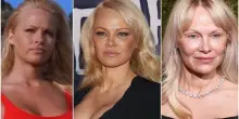 Pamela Anderson, prima e dopo: la mastoplastica additiva, i ritocchi alle labbra, l'addio al trucco: &laquo;A Los Angeles tutti si rifacevano il seno. Oggi preferisco essere autentica&raquo;