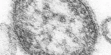 Morbillo: sintomi, contagio, cura, mortalit&agrave;, chi &egrave; a rischio e perch&eacute; i casi sono in aumento. Cosa sapere sul virus