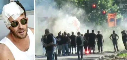 Tifoso ferito al derby Torino-Juventus, chiesto l'arresto di un poliziotto: l'ha colpito con un lacrimogeno sparato ad altezza d'uomo
