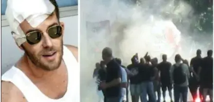 Tifoso ferito al derby di Torino, il pap&agrave;: &laquo;Quel poliziotto sapeva di aver colpito mio figlio, &egrave; stato zitto sperando di farla franca&raquo;