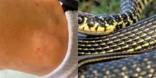 Passeggia per Roma e viene morso da un serpente: &laquo;Stavo saltando, mi ha attaccato&raquo;. Cosa dice l'esperto