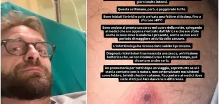 &laquo;Pensavo fosse un pelo incarnito, era una puntura di zecca africana&raquo;: Stefano Corti de Le Iene ricoverato per rickettsiosi