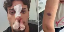 Trovano il posto auto disabili occupato dai vicini, mamma e figlio picchiati a sangue: &laquo;Gli hanno rotto il naso con il casco&raquo;